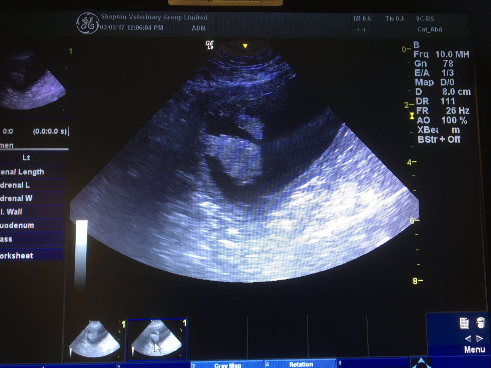 Chester's ultrasound image