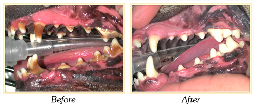 Before and after images showing teeth with tartar