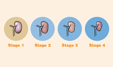 Chronic Kidney Disease (CKD) in Cats